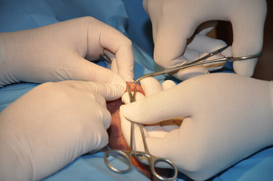 The beginning of sloughing of skin to show the vas deferens.